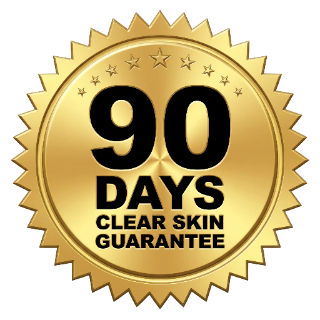90-Day Clear Skin Guarantee